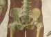 画像3: VINTAGE MEDICAL CHART ヴィンテージ メディカルチャート 人体図 解剖図 スカル ドクロ